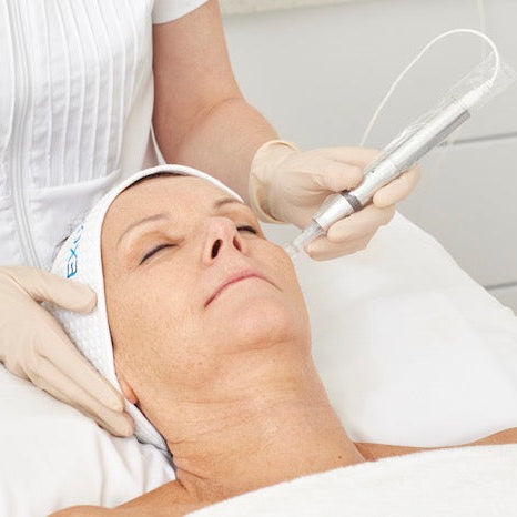 Skin Needling with the Exceed (collagen induction therapy)